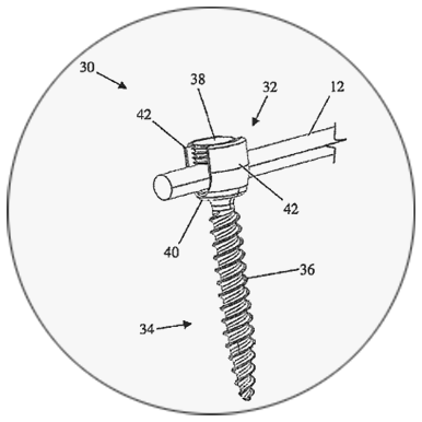 Patents-Spinal fixation construct