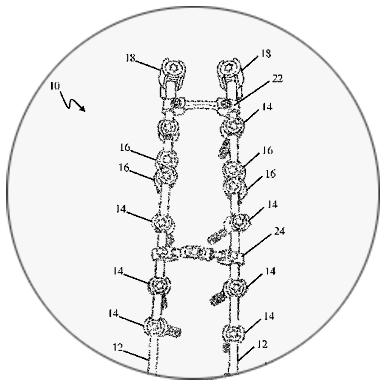 Spinal fixation construct