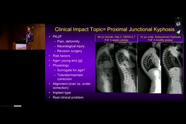 International Spine Study Group